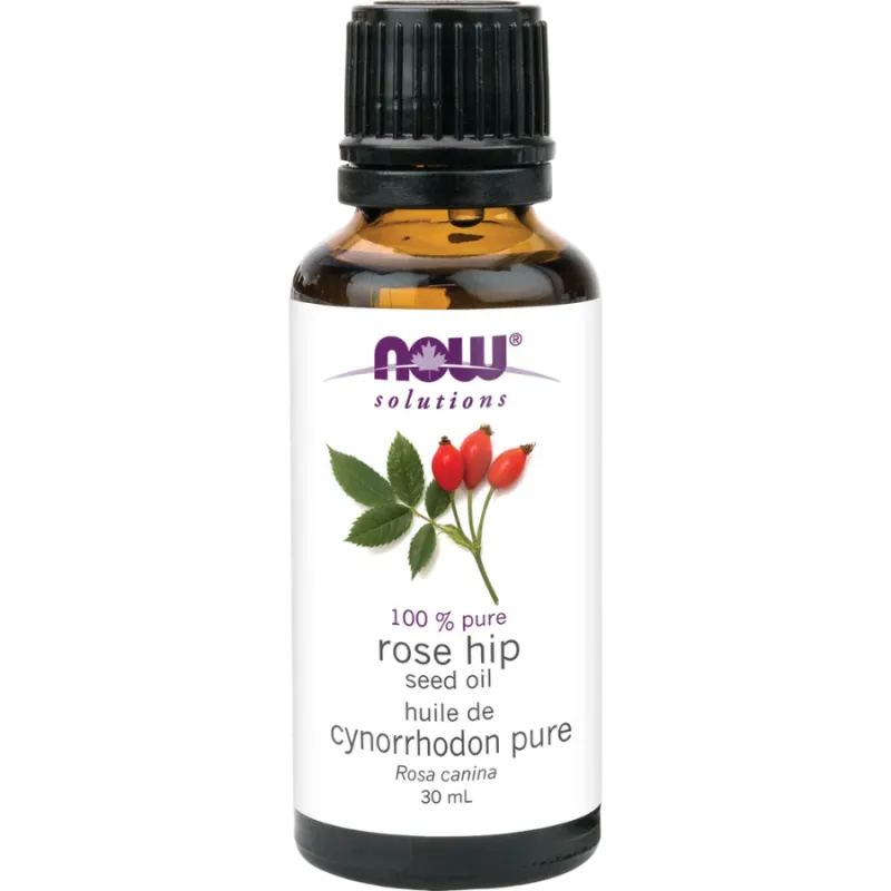 NOW Foods 나우 푸드 로즈힙 씨 오일 30mL | 매일 업데이트되는 특가 상품 | VITASHOP